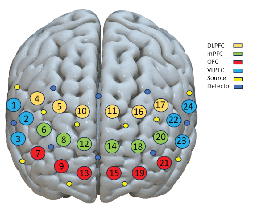 帕金森病患者的腦 - 體交互：雙任務(wù)表現(xiàn)研究揭示新機制